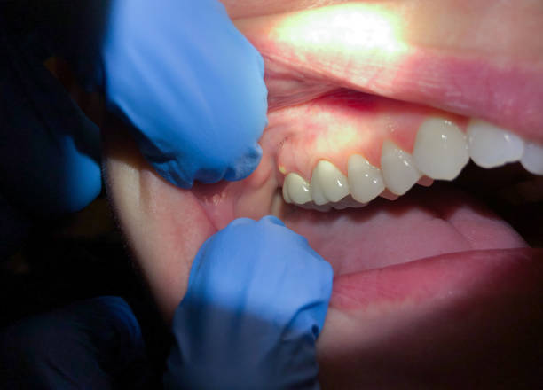 Best Emergency Cosmetic Dentistry in Fowlerville, MI