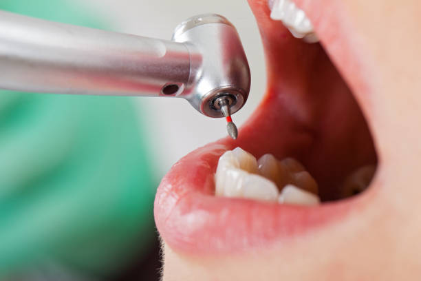 Best Weekend Emergency Dentist in Fowlerville, MI